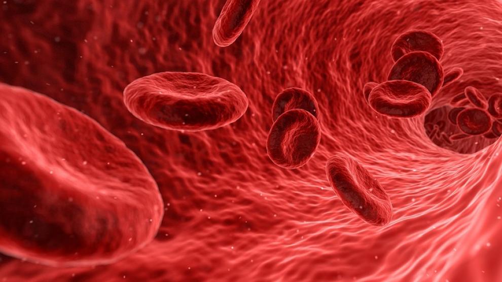 ANEMIA: NO SOLO UNA CARENCIA DE HIERRO. ABORDAJE MULTIFACTORIAL.